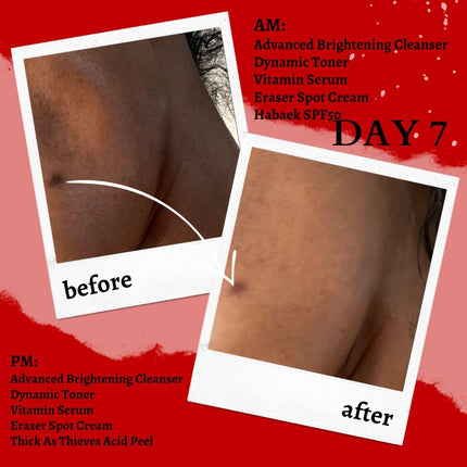 Gymsegbë - Thick As Thieves Pure Glycolic Acid Lactic Acid Extreme Gel Peel - 30ml