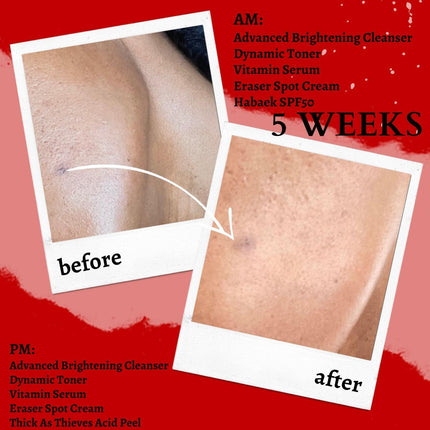 Gymsegbë - Thick As Thieves Pure Glycolic Acid Lactic Acid Extreme Gel Peel - 50ml