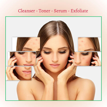 Gymsegbë - New Skin Natural Intensive Acne Serum