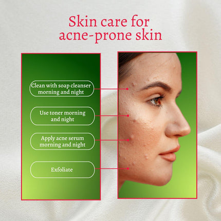 Gymsegbë - New Skin Natural Intensive Acne Serum