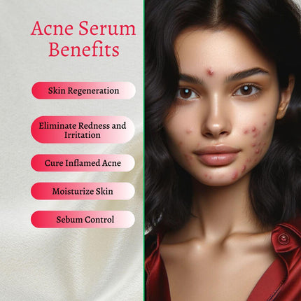 Gymsegbë - New Skin Natural Intensive Acne Serum