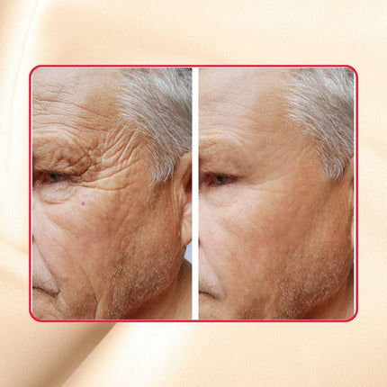 Gymsegbë - Thick As Thieves Pure Glycolic Acid Lactic Acid Extreme Gel Peel - 30ml