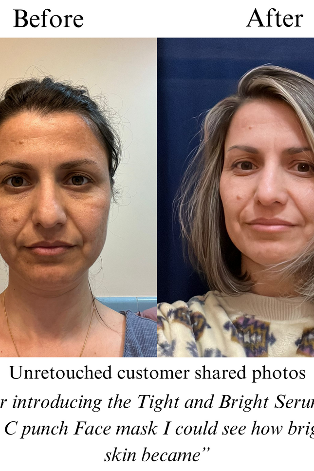 NILCEUTICA - Vitamin C Punch,IMMEDIATE BRIGHTENING FACE MASK,  pH balanced formula