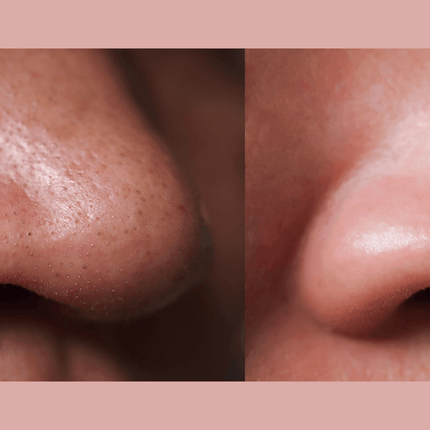 Gymsegbë - Ultra-Advanced Anti-Aging Daily Resurfacing Pads