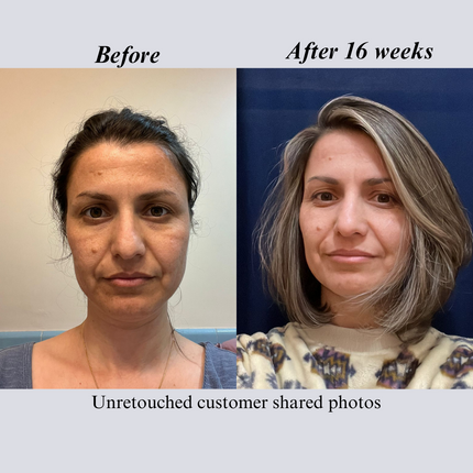 NILCEUTICA - NILCEUTICA Bestsellers Discovery and Travel kit