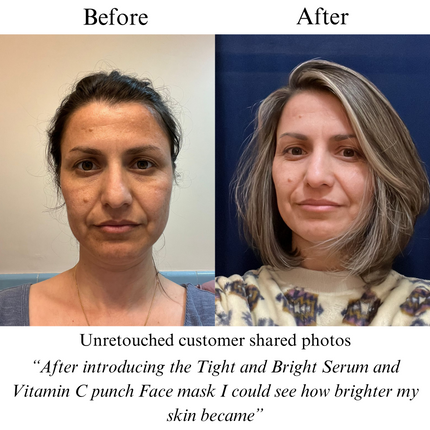 NILCEUTICA - TIGHT AND BRIGHT, an Advanced Gentle Phyto-Retinol and Vitamin C Face Serum, 12 Innovative Technologies, 55% High-Performance Cosmeceuticals