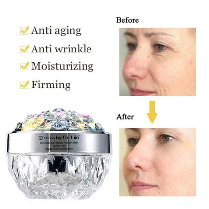 EpiLynx - Anti-Aging Retinol Night Moisturizer for Radiant Skin