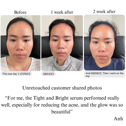 NILCEUTICA - TIGHT AND BRIGHT, an Advanced Gentle Phyto-Retinol and Vitamin C Face Serum, 12 Innovative Technologies, 55% High-Performance Cosmeceuticals