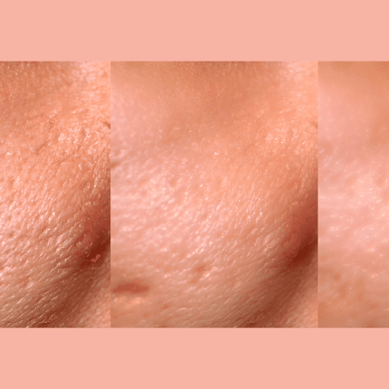 Gymsegbë - Ultra-Advanced Anti-Aging Daily Resurfacing Pads