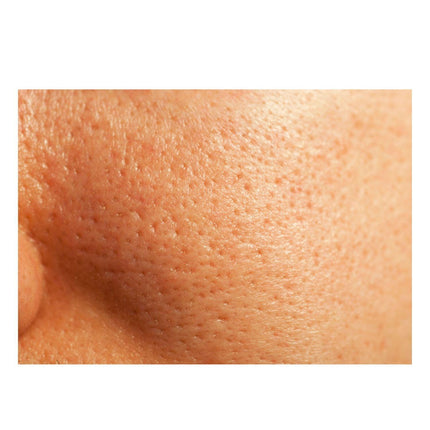 Gymsegbë - Thick As Thieves Pure Glycolic Acid Lactic Acid Extreme Gel Peel - 50ml