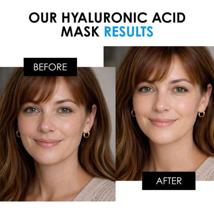 skinChemists US - Hyaluronic Acid Mask 50ml