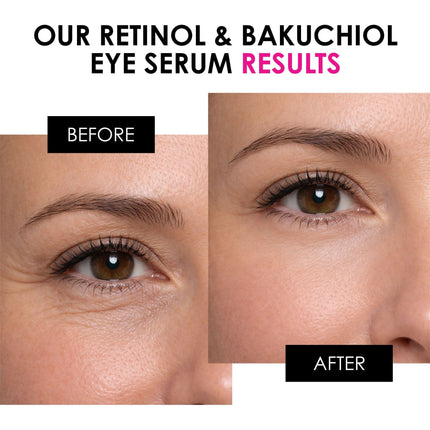 skinChemists US - Retinol & Bakuchiol Eye Serum 15ml