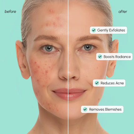 Maree - Azelaic Acid Soothing Pads