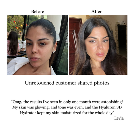 NILCEUTICA - Hyaluron 3D Hydrator Multi Lamellar Emulsion The Advanced Response Face and Neck Cream-Serum