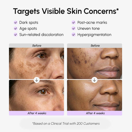 Maree - Face & Body Serum for Dark Spots