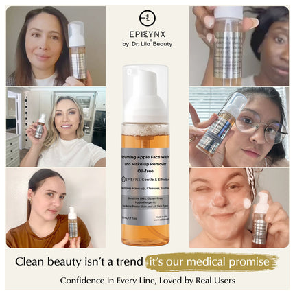 EpiLynx - Gentle, Oil-Free Foaming Apple Cleanser for Sensitive & Acne-Prone Skin | Vegan, allergen-friendly, sulfate & paraben free | Purifying, hydrating face wash for all skin types