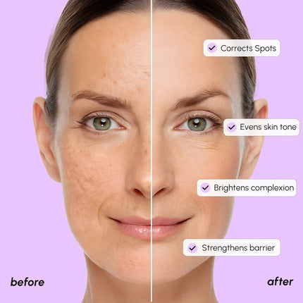 Maree - Dark Spot Corrector