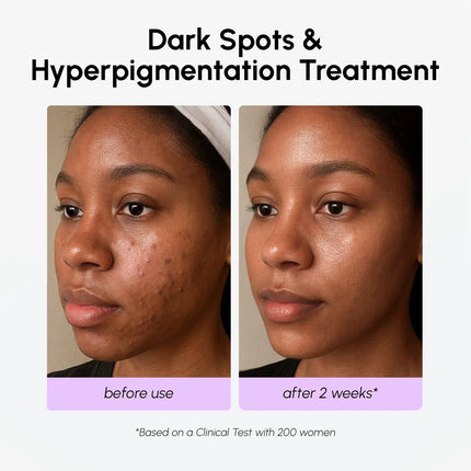 Maree - Dark Spot Corrector
