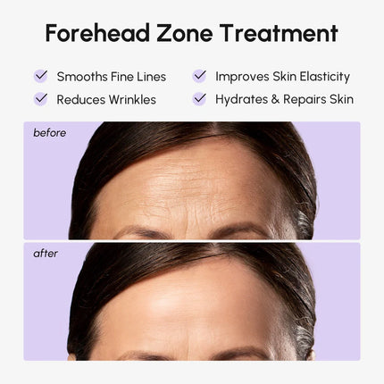 Maree - Anti-Wrinkle Forehead Patches