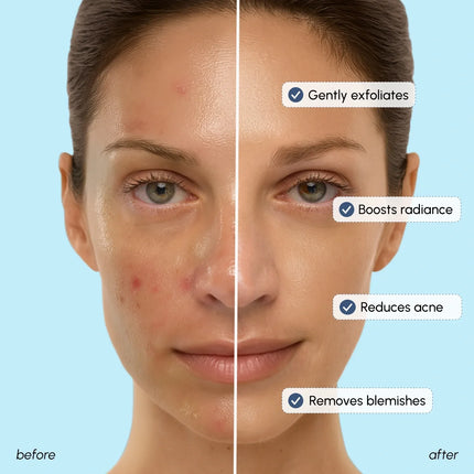 Maree - Glow Boost Glycolic Face Toner