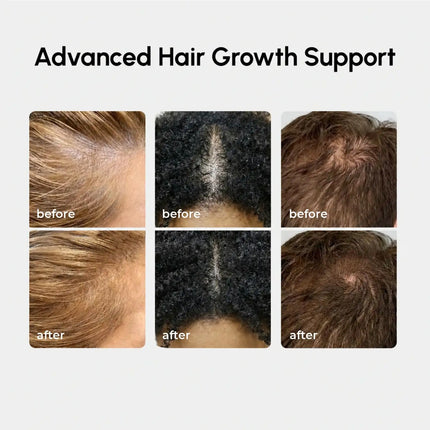 Maree - 4-in-1 Hair Growth Spray