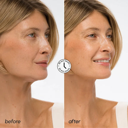 Maree - Hyaluronic Acid V-line Lifting Mask