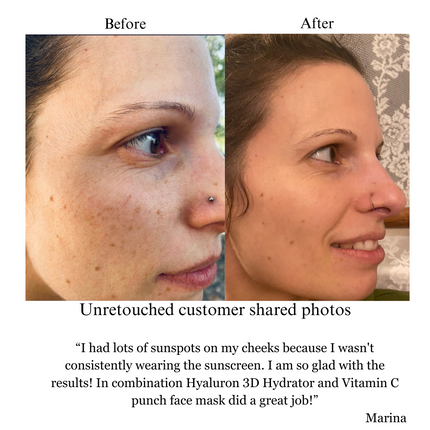 NILCEUTICA - Hyaluron 3D Hydrator Multi Lamellar Emulsion The Advanced Response Face and Neck Cream-Serum