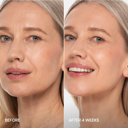 Maree - Pro-Retinol Neck Lifting Cream Massager