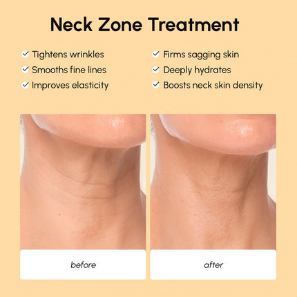Maree - Lifting Neck Wrinkle Patches