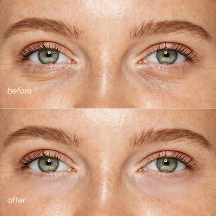 Maree - Pink Eye Patches for Puffy Eyes