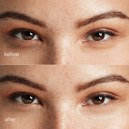Maree - Pink Eye Patches for Puffy Eyes