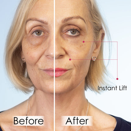 skinChemists US - Wrinkle Killer Instant Lift with Hyaluronic Acid & Peptides