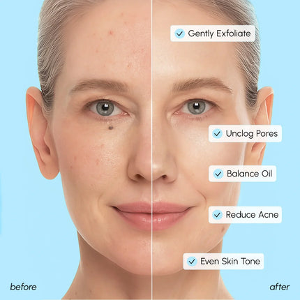 Maree - Glycolic & Salicylic Acid Peel Pads