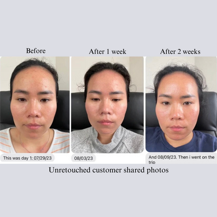 NILCEUTICA - NILCEUTICA Bestsellers Discovery and Travel kit