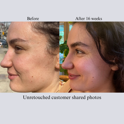 NILCEUTICA - TIGHT AND BRIGHT, an Advanced Gentle Phyto-Retinol and Vitamin C Face Serum, 12 Innovative Technologies, 55% High-Performance Cosmeceuticals