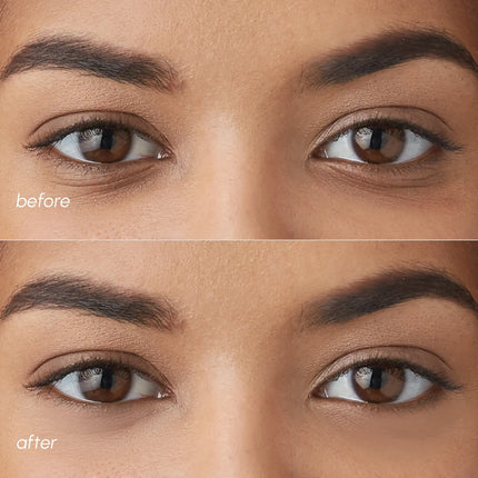 Maree - Violet Eye Patches for Dark Circles