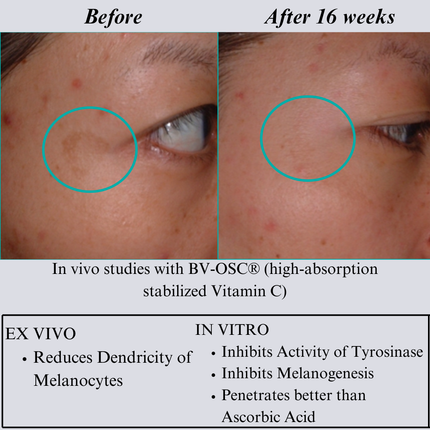 NILCEUTICA - NILCEUTICA Bestsellers Discovery and Travel kit