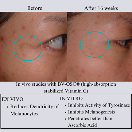 NILCEUTICA - Hyaluron 3D Hydrator Multi Lamellar Emulsion The Advanced Response Face and Neck Cream-Serum