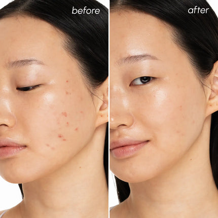 Maree - Witch Hazel Clearing Pads