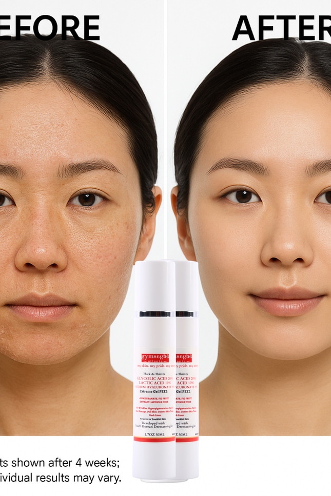 Gymsegbë - Thick As Thieves Pure Glycolic Acid Lactic Acid Extreme Gel Peel - 50ml