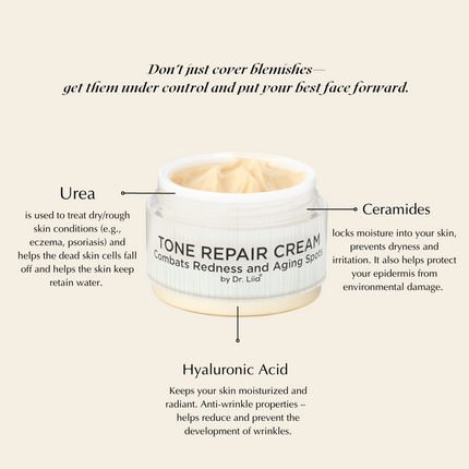 EpiLynx - Brightening Face Cream for Redness & Hyperpigmentation