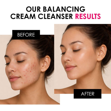 skinChemists US - Balancing Vitamin C & Glycolic Acid Cream Cleanser 200ml