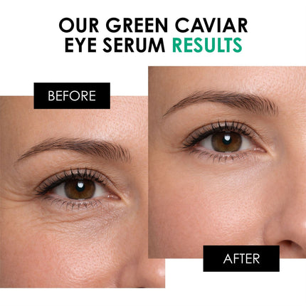 skinChemists US - Green Caviar Eye Serum 15ml