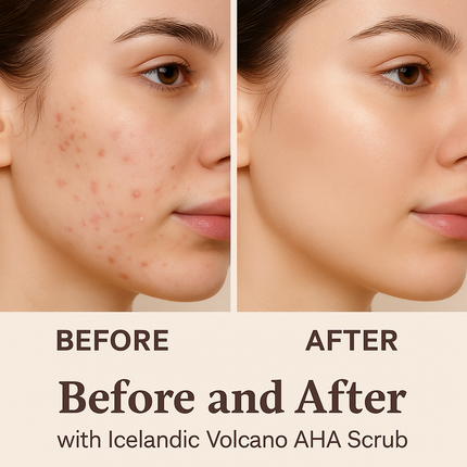 REK Cosmetics - Icelandic Volcano AHA Face & Body Scrub