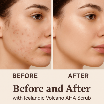 REK Cosmetics - Icelandic Volcano AHA Face & Body Scrub