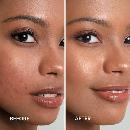 Maree - Turmeric Kojic Soap & Scrub